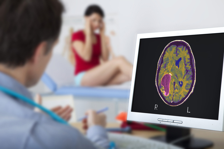 Doctor reviewing a brain scan on a monitor while a patient sits in the background holding her head.