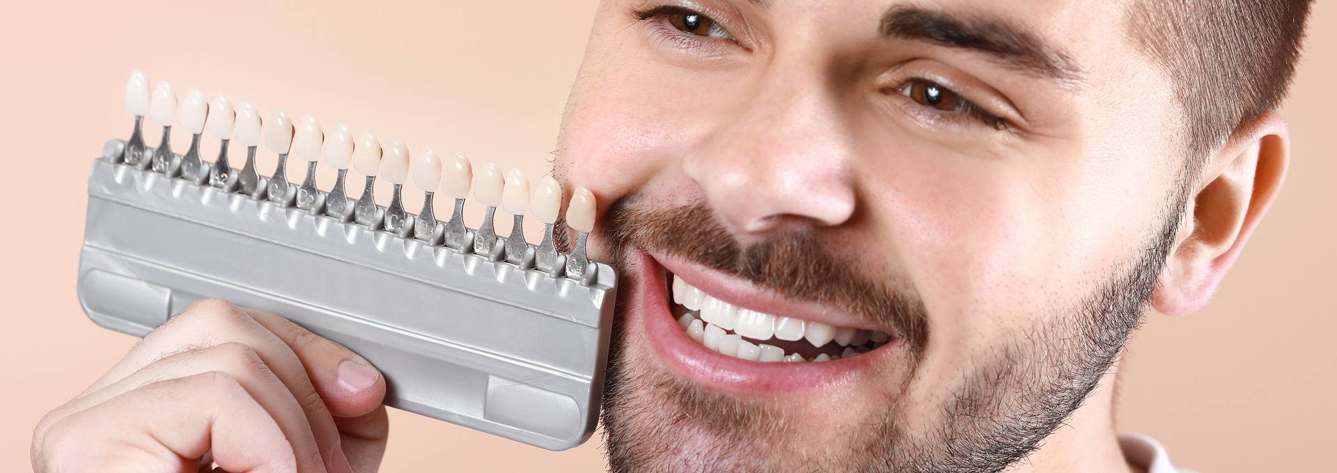 Tout ce que vous devez savoir sur les facettes – Définition, coût,  recommandations et plus, image size:1920x680