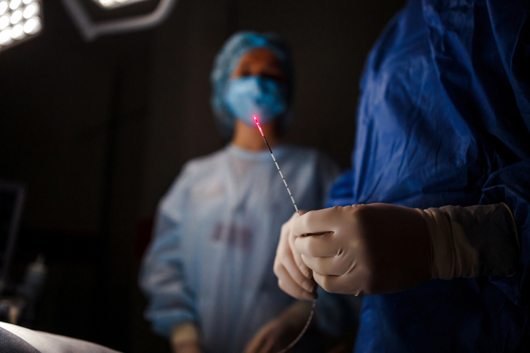 Varicose Vein Treatments