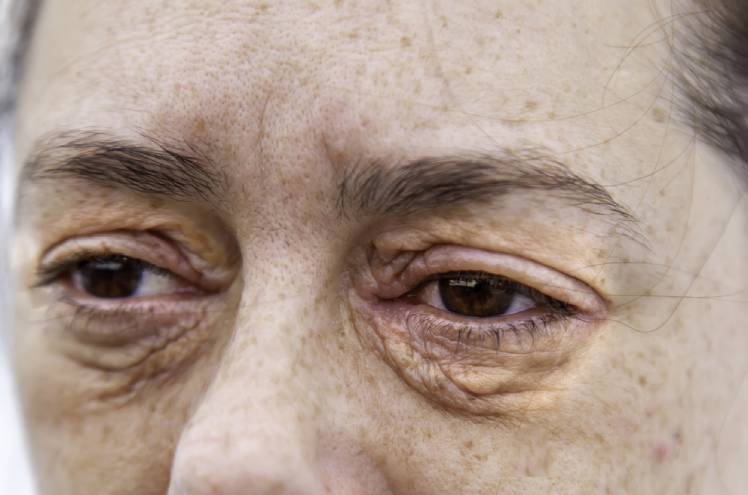 Allergies and Skin