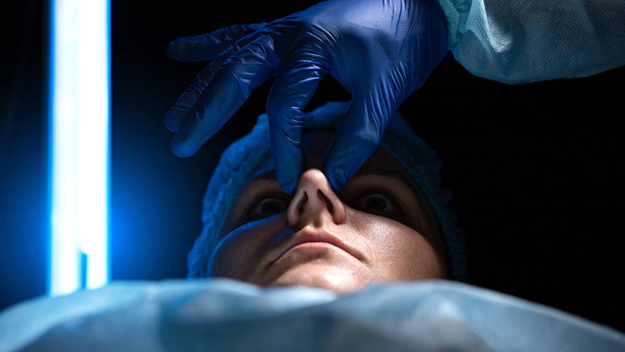 Nostril Reduction Surgery