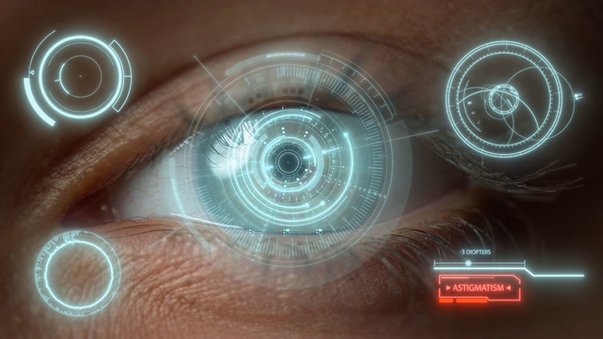 Astigmatism