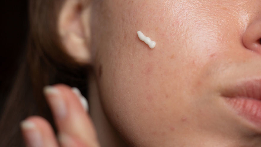 Solutions for Uneven Skin Texture