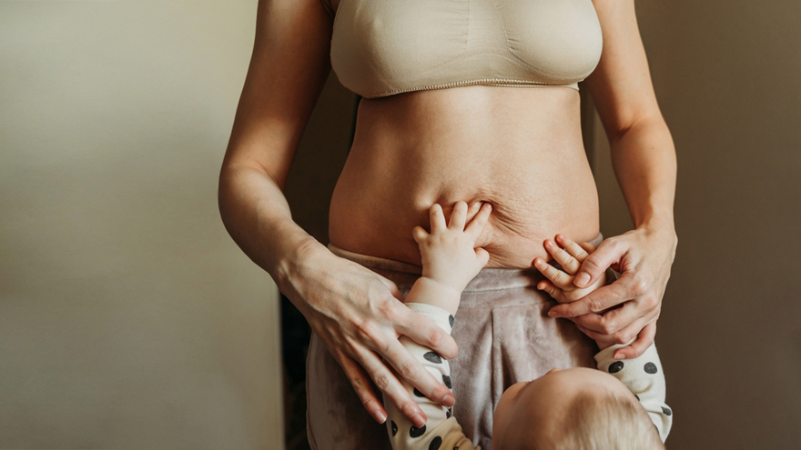 Skin After Pregnancy