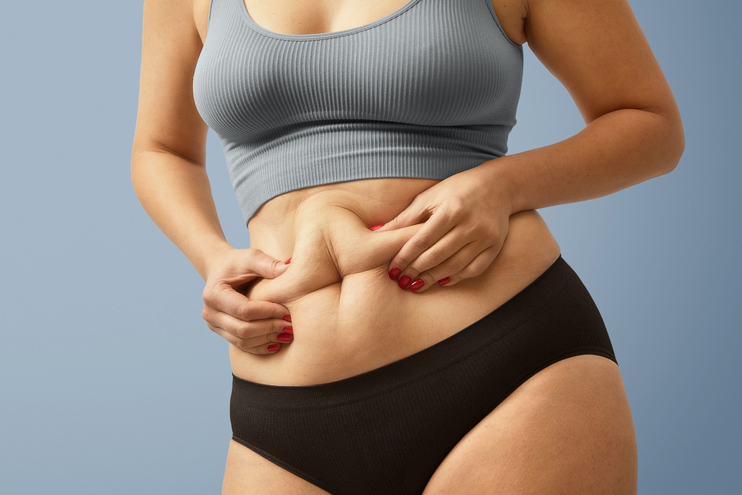 Fat Reduction Treatments