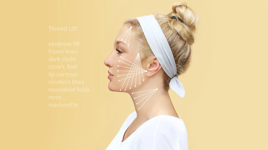 Thread Lift Aftercare: Why Sleeping Position Matters