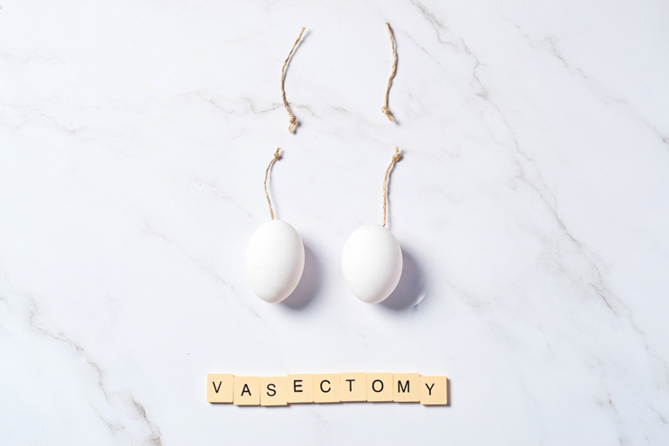 Vasectomy