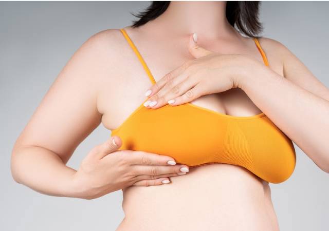 Breast Ptosis