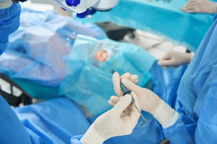 SMILE Surgery