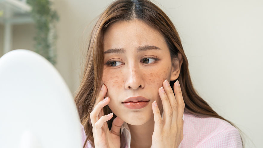 Sensitive Skin