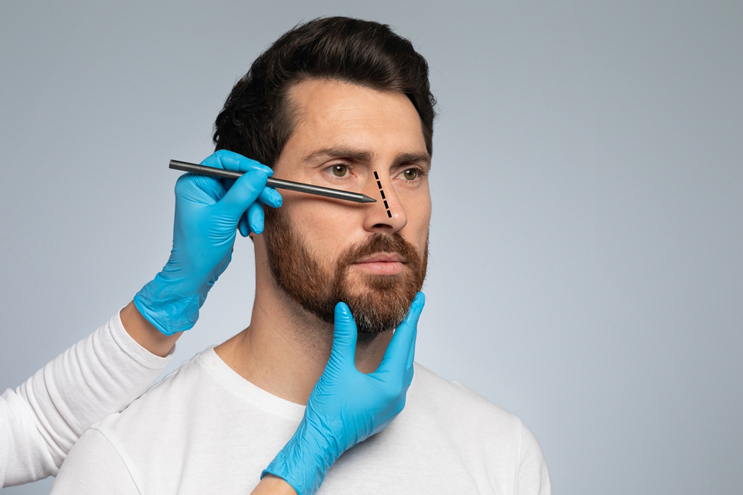 Protruding Nose Without Losing Facial Balance