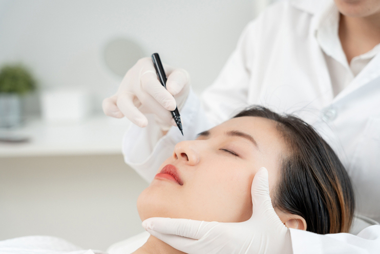 Rhinoplasty 