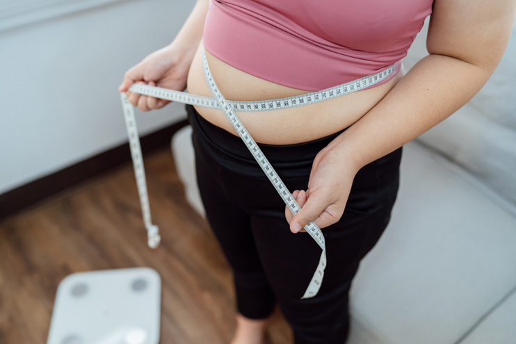 Obesity and Varicose Veins