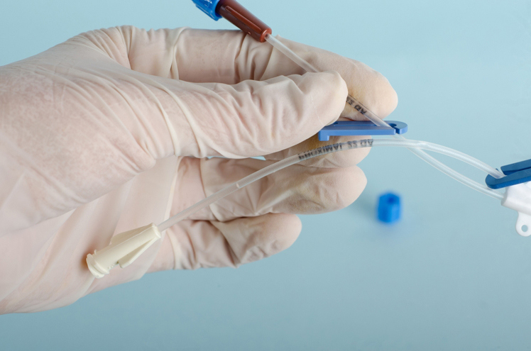 Dialysis Access Sites