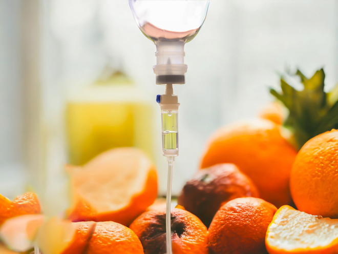 IV Vitamin Therapy