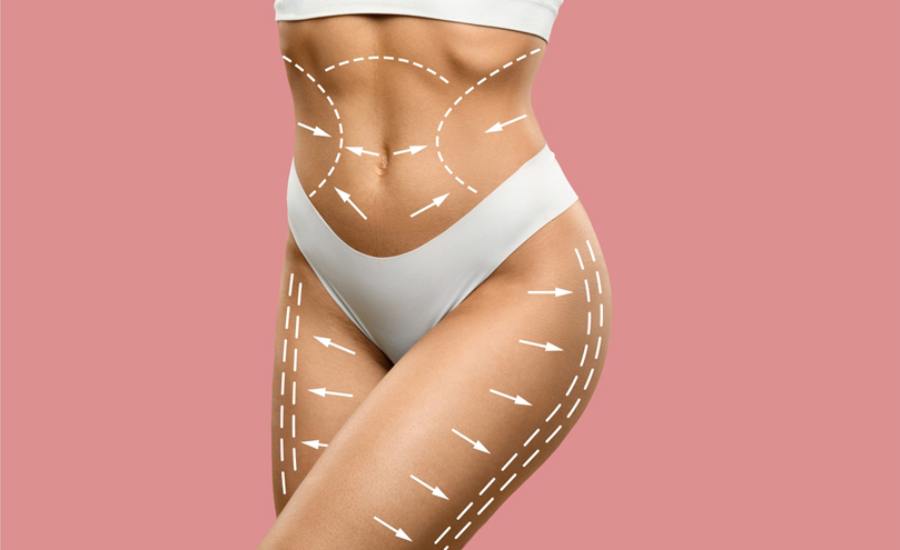 Fat Reduction