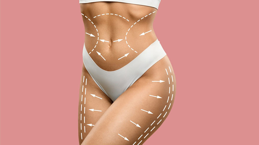 Body Sculpting