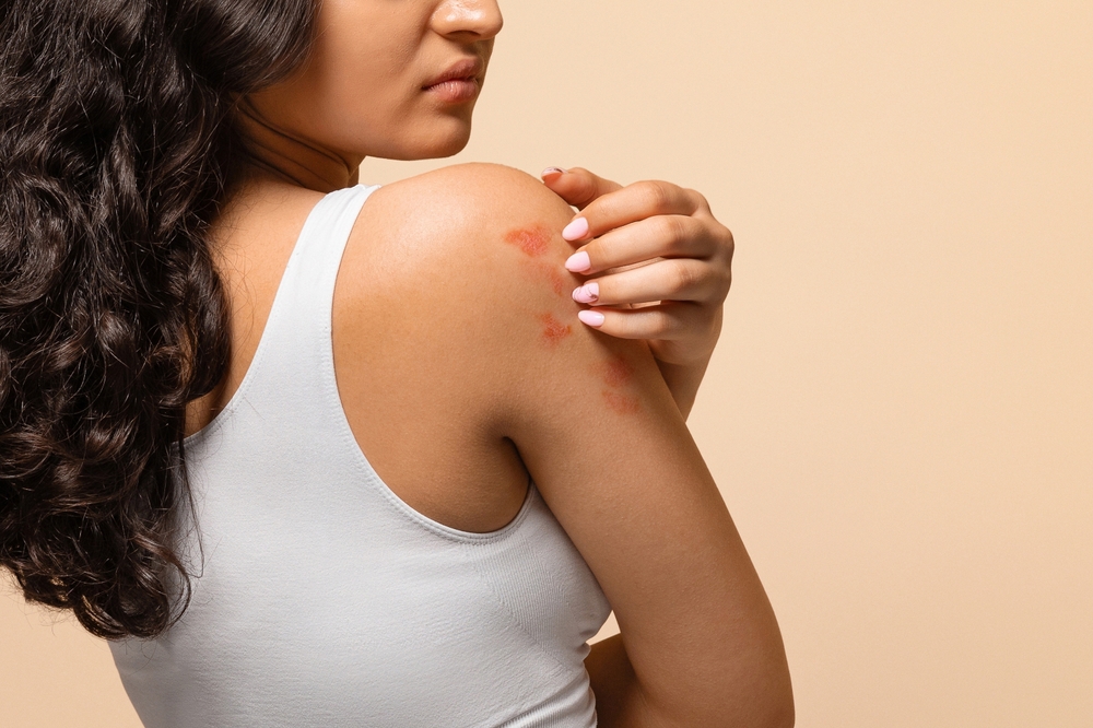 Skin Sensitivity