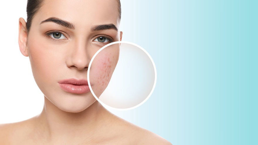 Sensitive Skin Areas