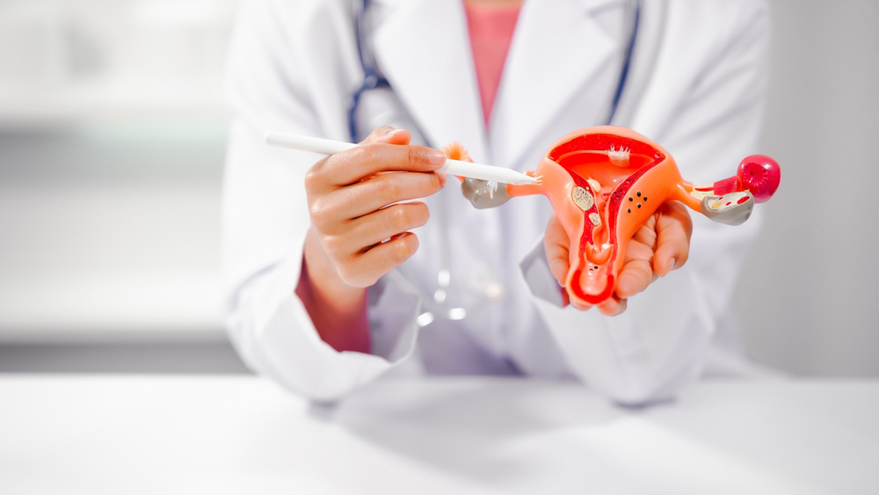 Uterine Fibroids