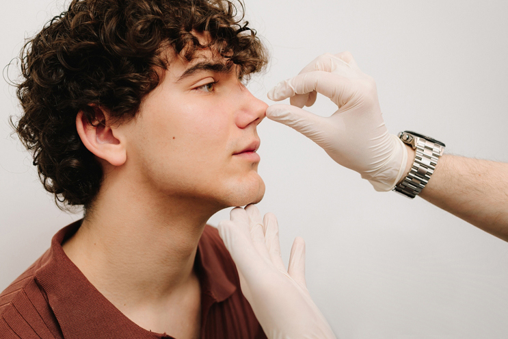 Rhinoplasty for Men