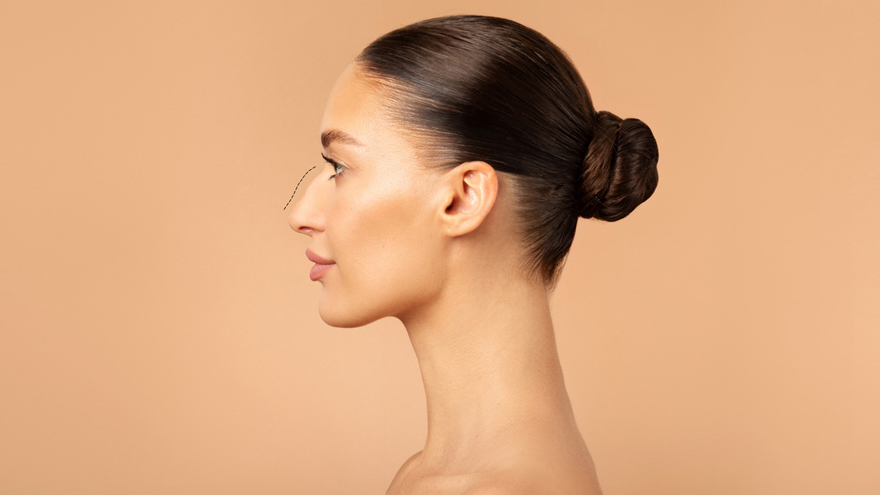 Apakah Operasi Hidung (Rhinoplasty) Cocok untuk Anda? Wawasan Ahli dari Pusat Bedah Plastik Terkemuka di Korea