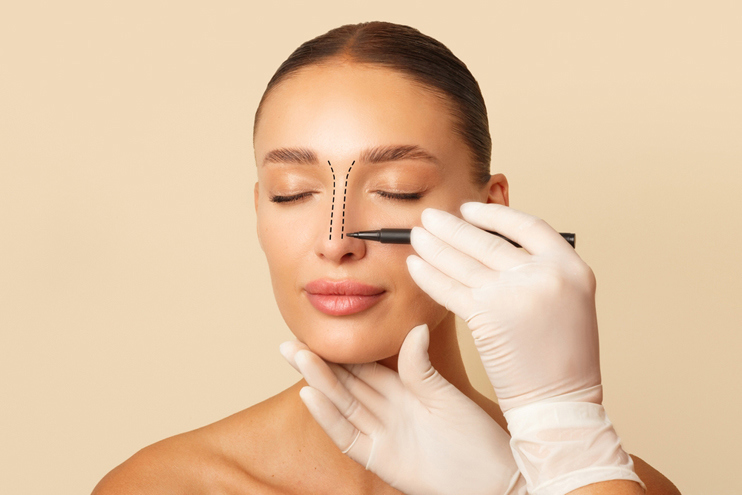 Rhinoplasty