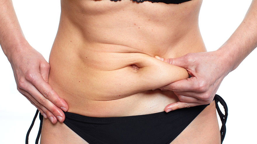 Loose Skin