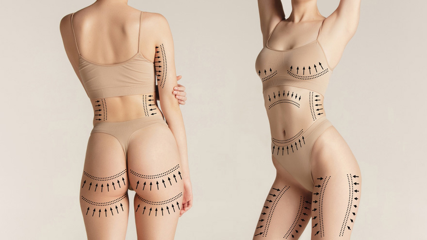 Front and back views of women in beige underwear with dotted lines and arrows indicating body contouring areas.