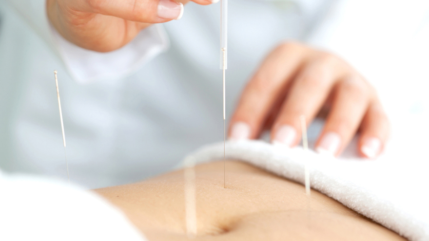 Endometriosis Pain Management