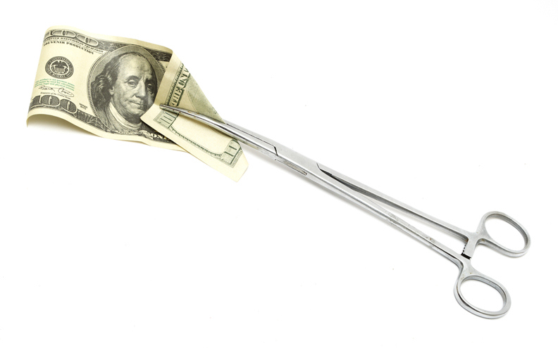 Varicose Vein Surgery