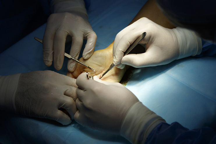 Cirugía de la Mano (Microcirugía)