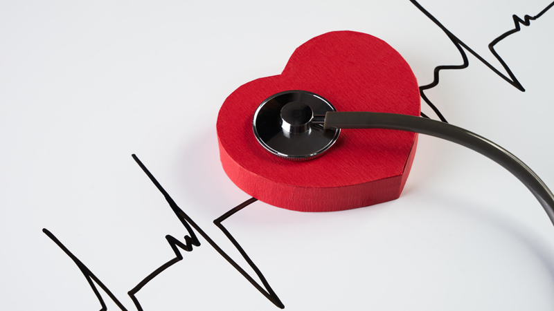 Atrial Flutter: Classification, Causes, Ecg Diagnosis & Management