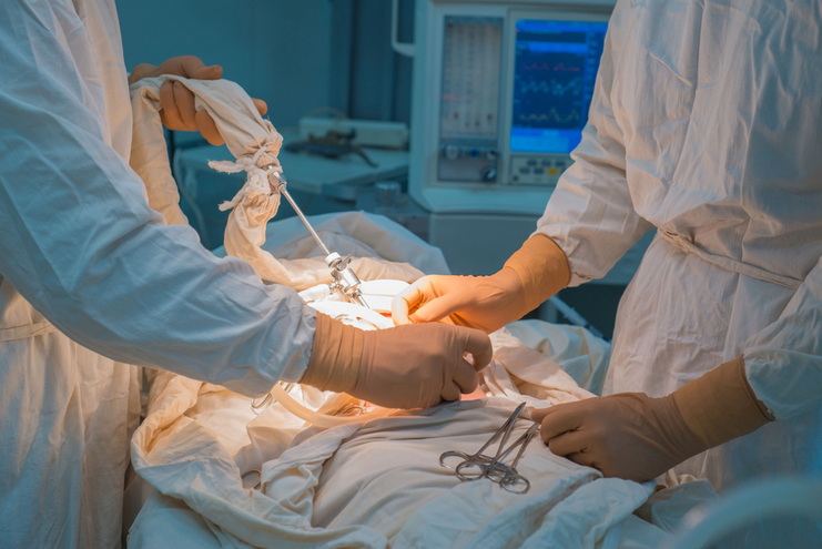 Neonatal Laparoscopic Surgery