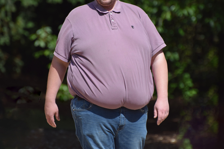 Obesidad mórbida