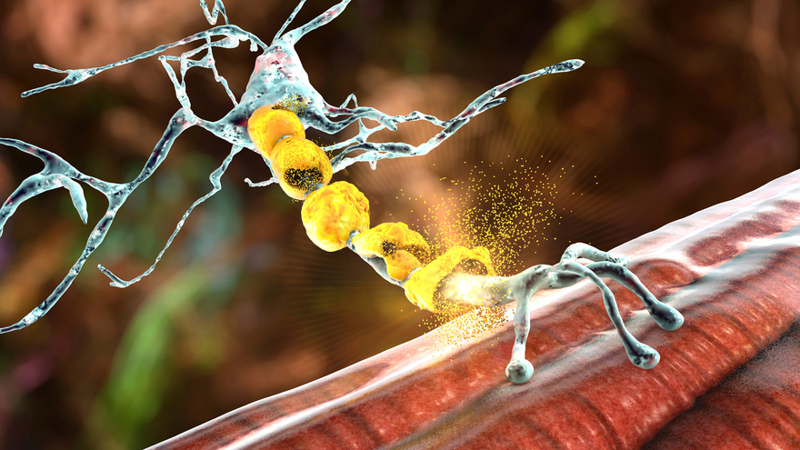 Neuromuscular Diseases