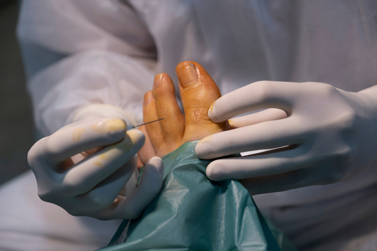 Minimally Invasive Foot Surgery 8329