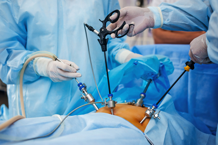 phẫu thuật robot và phẫu thuật nội soi