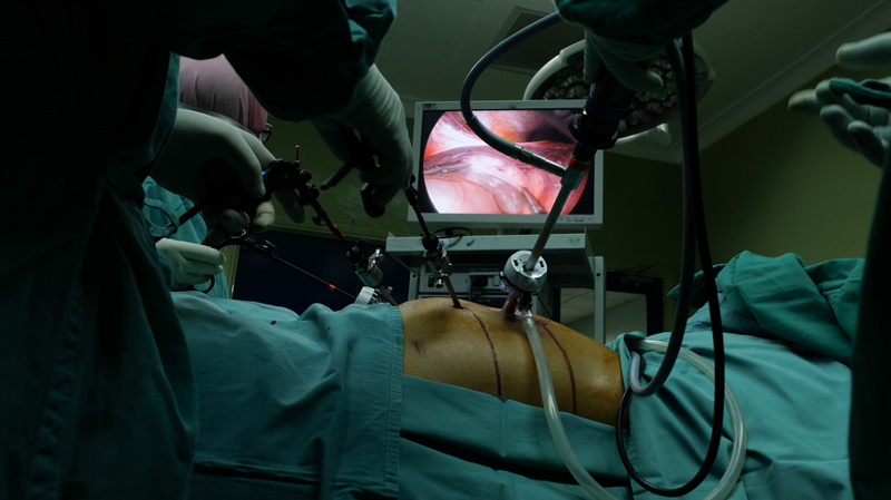 Gallbladder Operation