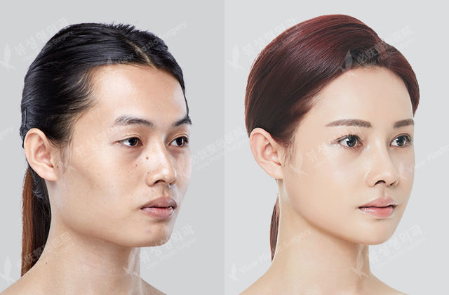 Face contouring before and after