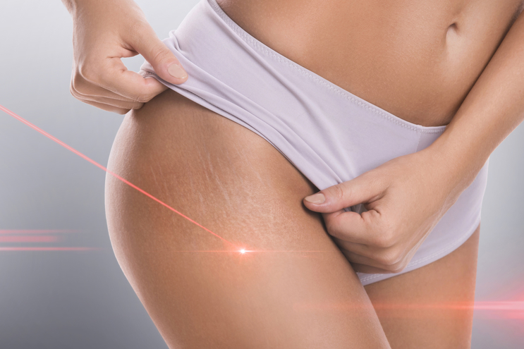 Laser therapy risks
