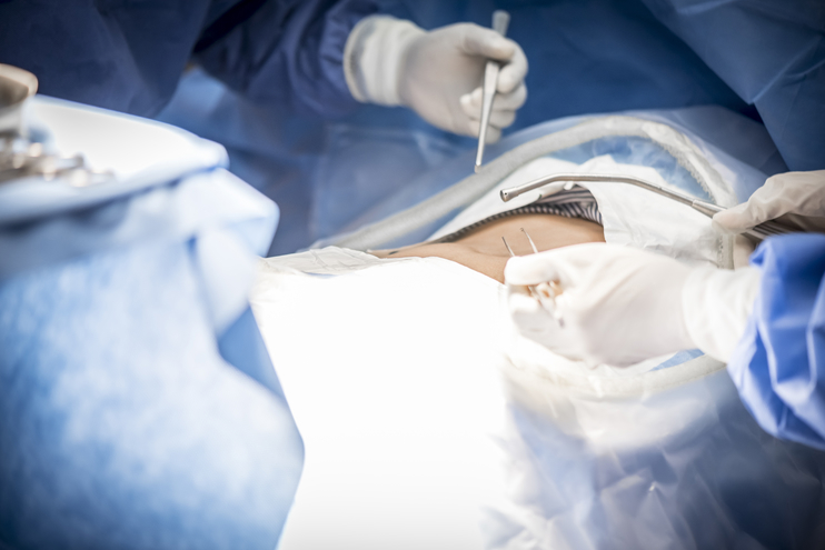 Laparoscopic Urological Surgery