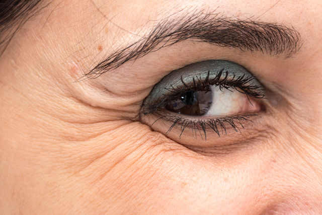 Eye wrinkles classification