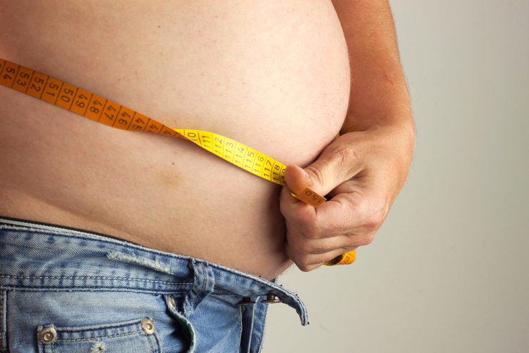  Định nghĩa bệnh béo phì