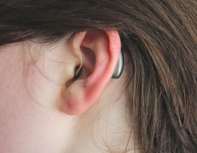 Sensorineural hearing loss meaning