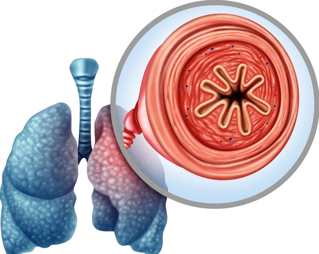 Obstructive pulmonary and respiratory diseases