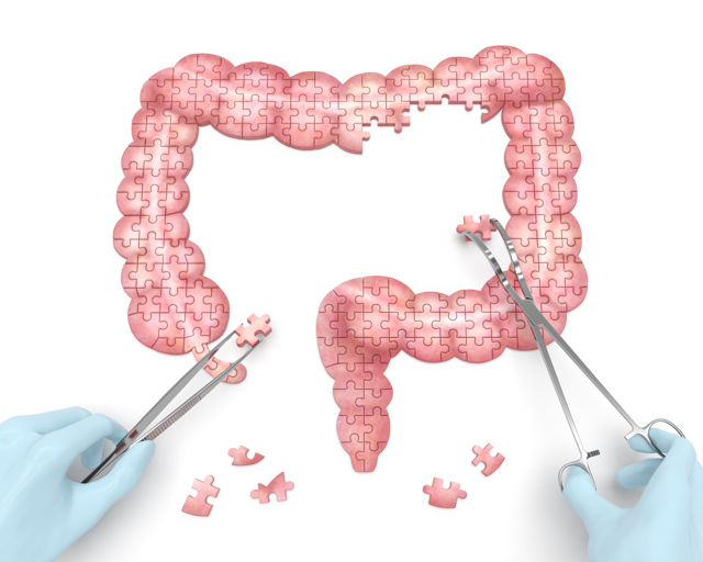 Colorectal Surgery   2 Colorectal Surgery Dd097825 D166 4c4d 96fe E7d7ce8f2661 