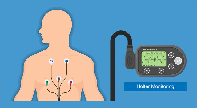 24hr Holter monitoring