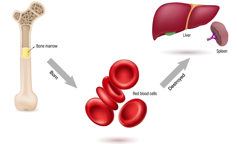 anemia-in-newborns