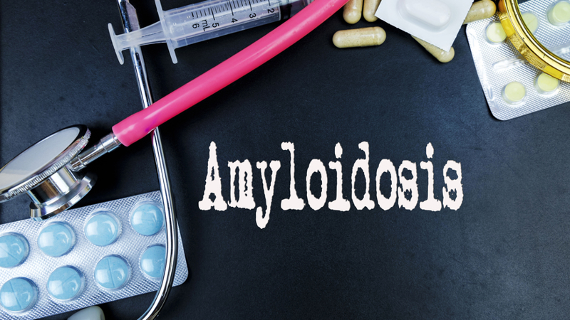 AA Amyloidosis